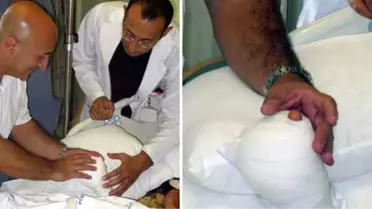 Ayak Parmaklarını Eline Diktiriyor