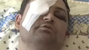 TRT Muhabirine Ankara'da Maganda Dayağı