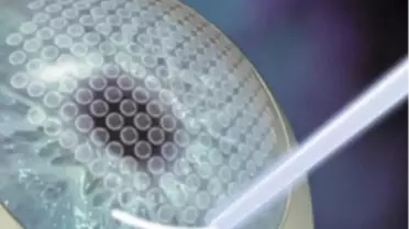 İ-Lasık Teknolojisi Dünyagöz'de!