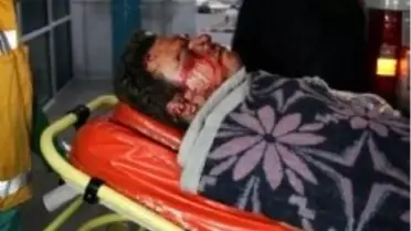 Patlamada Ölen ve Yaralananların Kimlikleri Belirlendi