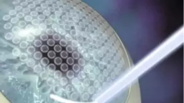 Göz Bozukluğu Tedavisinde İ-Lasık