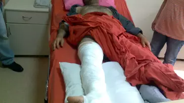 Polis Karakolunda Ayak Kıran İşkence İddiası