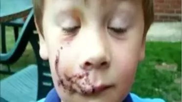 İngiltere'de Köpek Dehşeti