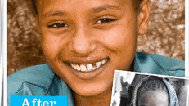 Dünyanın Dört Bir Yanından Diş Hekimleri İstanbul'da Bir Araya Geliyor