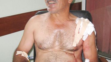 Çoban, 'koyunları Yoldan Çek' Diyen Sürücüyü Vurdu