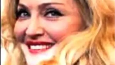 Yüzü Deforme Olmuş!