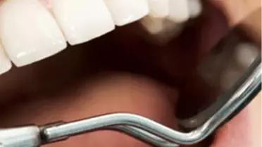 Ağız ve Diş Bakımında Doğru Bildiğimiz Yanlışlar