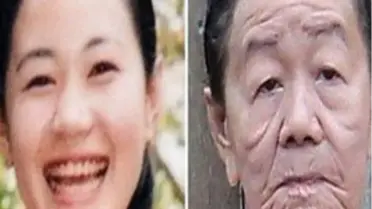 Vietnam'da Birkaç Gün İçinde 50 Yaş Yaşlanan Kadın