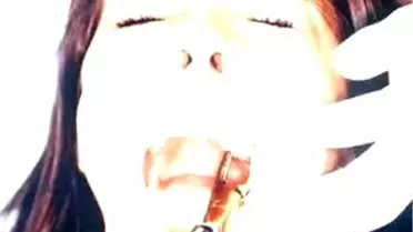 Yanlış Beslenme Diş Çürütüyor!