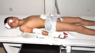 Elinde Bomba Patlayan Çocuk Ağır Yaralandı