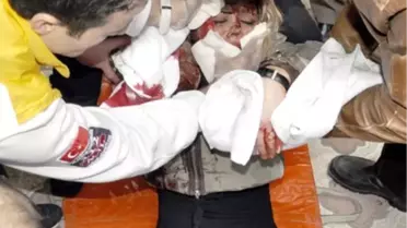 Eski Eşini Sokak Ortasında Falçatayla Yaraladı