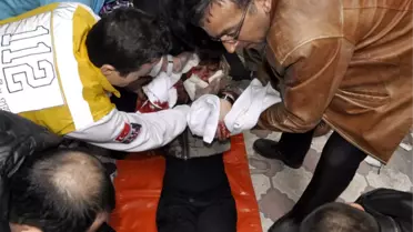 Eski Eşini Falçatayla Yaralayan Polise Teslim Oldu