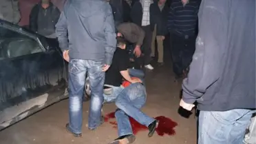 Tabancayla Bacaklarından Vuruldu, İlk Müdahaleyi Arkadaşları Yaptı