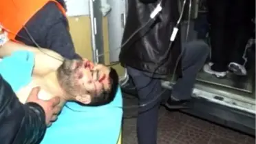 Kozan'da Trafik Kazası: 2 Yaralı