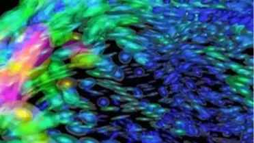 Beyninizin Ne Tarafını Kullanıyorsunuz?