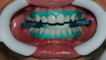 Dilediğiniz Gülümsemeye 'Klinik 32' ile Kavuşun!