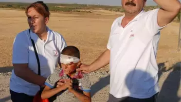 Otomobil, Bisiklete Çarptı, 2 Çocuk Yaralandı