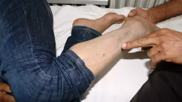 Yılan Tarafından 2. Kez Isırılan Genç Kızın Kabusu