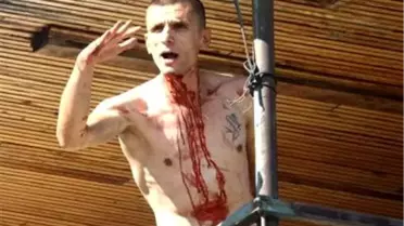 Eşiyle Tartıştı, Falçatayla Kendini Kesti