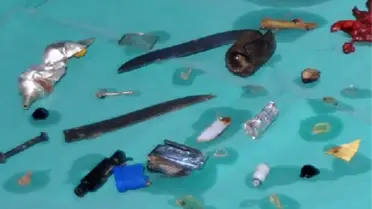 Şizofreni Hastası Eline Ne Geçtiyse Yutmuş