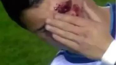 Ronaldo Kan Revan İçinde Kaldı