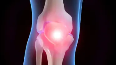 Kireçlenme Nasıl Tedavi Edilir?