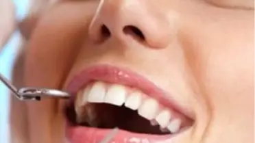 Görünmeyen Diş Telleri Özgürleştiriyor