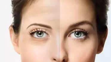 Depresyondan Çıkmanın Yolu Botoks'tan Geçiyor