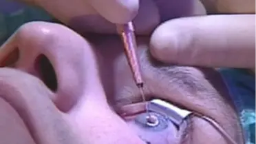 Doktorlara 'Oğlumu Kör Ettiniz' Davası