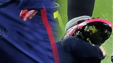 Messi Kanlar İçinde Kaldı