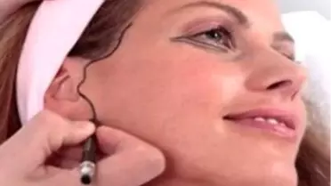 Kulak Estetiğinde Gelinen Son Nokta
