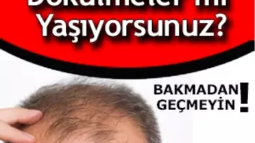 Saç Ekimi Hakkında Tüm Gerçekler


