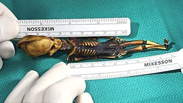 Uzaylı Sanılan İskelet İnsan Çıktı