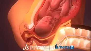 BornToBeAlive: Doğuma 3 Boyutlu Bakış