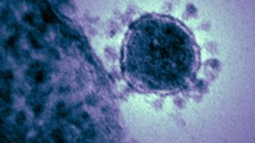 Sars Virüsünden Daha Tehlikeli Olan Mers 38 Can Aldı