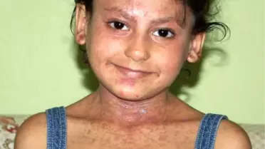 Minik Büşra'ya Hayat Işığı Göründü