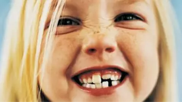 Süt Dişlerinin Bakımına İhmal Etmeyin