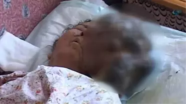 Yüzünde Çıkan Ur 4,5 Kiloya Ulaştı