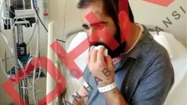 Yüz Nakli Olan Salih Üslün'ün İlk Görüntüsü