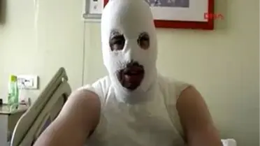 17 Günlük Damat Kendini Yaktı