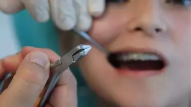 Ortodonti Sadece Estetik Demek Değil