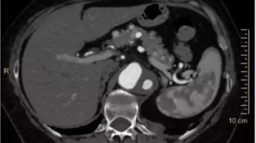 RSNA 2013'de Klinisyenlerin Beğenisine Sundu