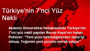 Türkiye'nin 7'nci Yüz Nakli
