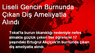 Liseli Gencin Burnunda Çıkan Diş Ameliyatla Alındı