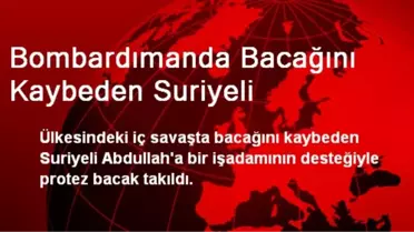 Bombardımanda Bacağını Kaybeden Suriyeliye Protez Takıldı