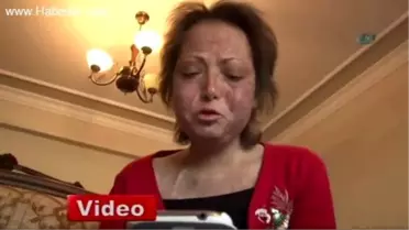 Kanseri Evlat Sevgisiyle Yendi