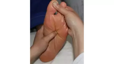 Avrasya Engelliler Platformu'nda Serebral Palsy Konuşuldu