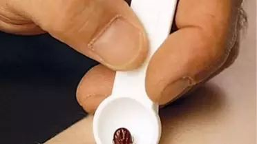 Kenenin Isırdığı Yaşlı Adam Kkka Şüphesiyle Tedavi Altına Alındı