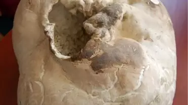 5 Kilogramlık Dev Mantar