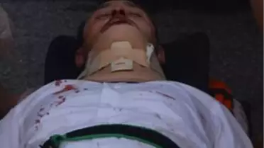 Fatsa'daki Trafik Kazaları: 3 Yaralı